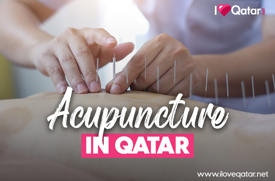 Where to get acupuncture treatment in Qatar